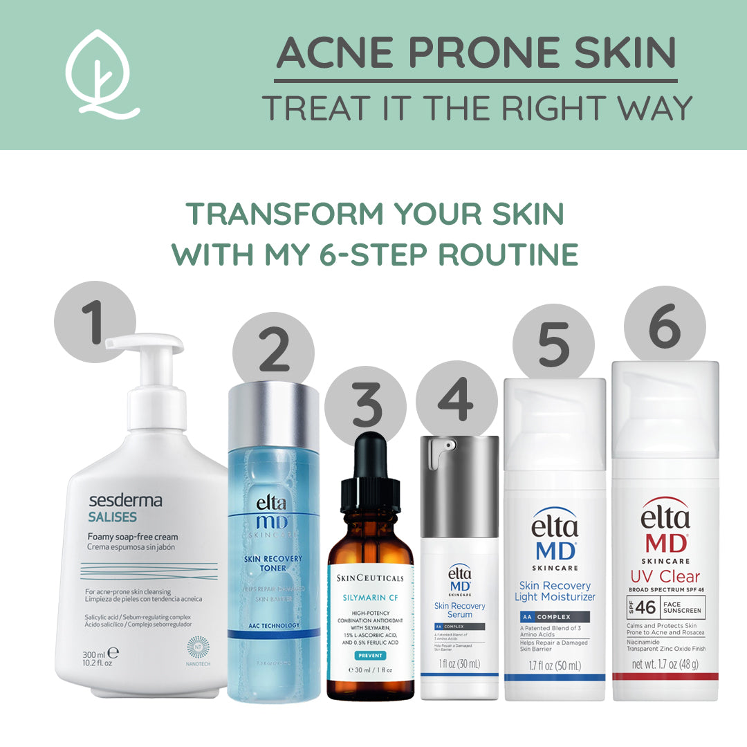 Acne Prone Skincare Routine